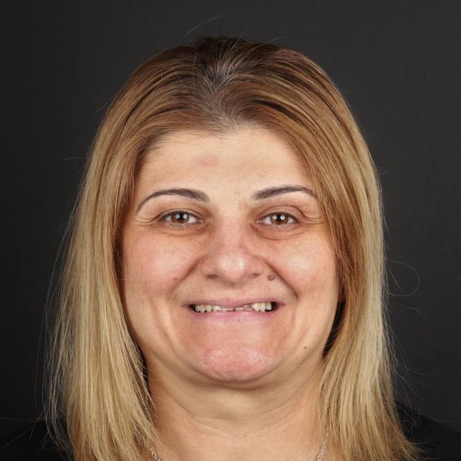 All-on-4, All-in-4 имплантация, протезирование, вернуть зубы, протезирование на имплантах, всё-на-4, все-на-четырех, протезирование зубов