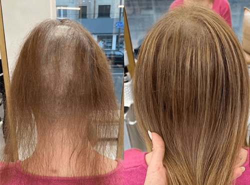 Professional Hair Extensions In Dubai Marina professional-hair-extensions-in-dubai-marina