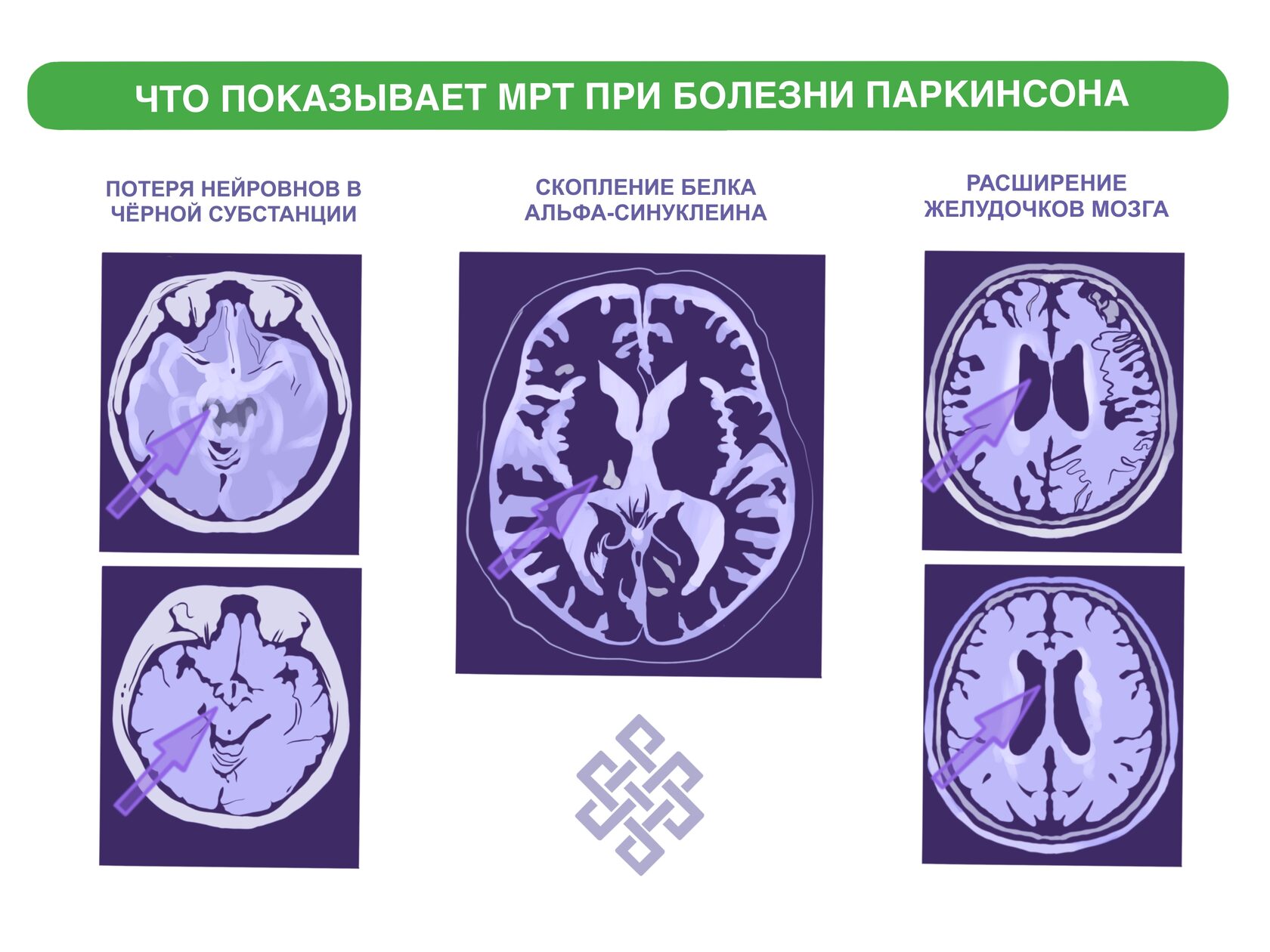 Баланит (Баланопостит) - причины, симптомы, диагностика, лечение и профилактика