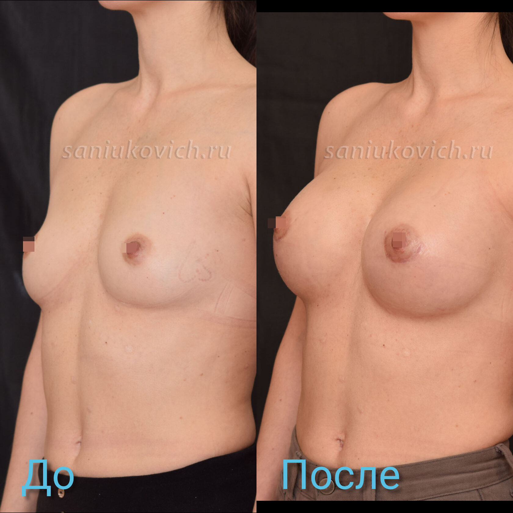 массаж для увеличении грудью фото 119