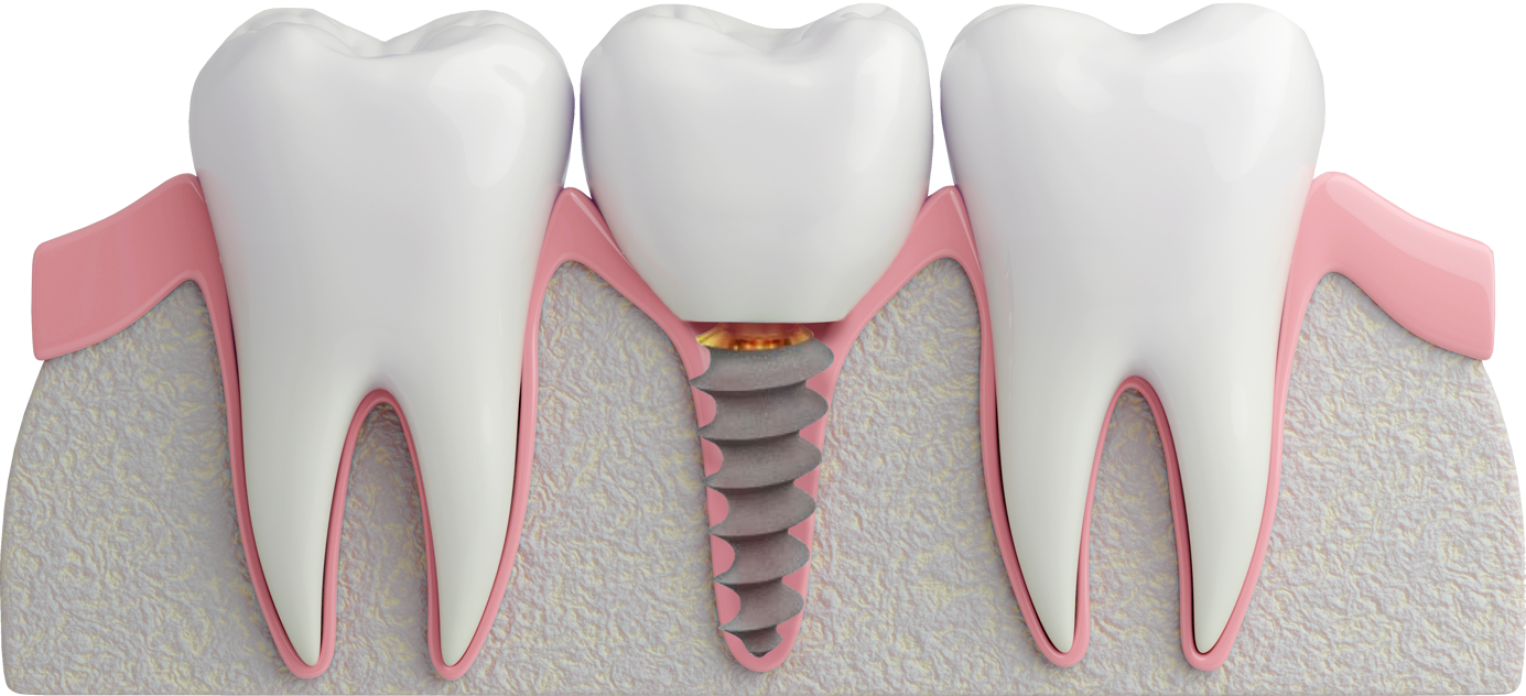 Африкалық секс