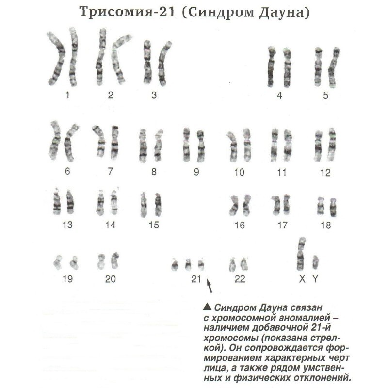 den-sindroma-dayna-2.jpg