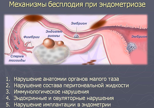 Эндометриоз кожи фото