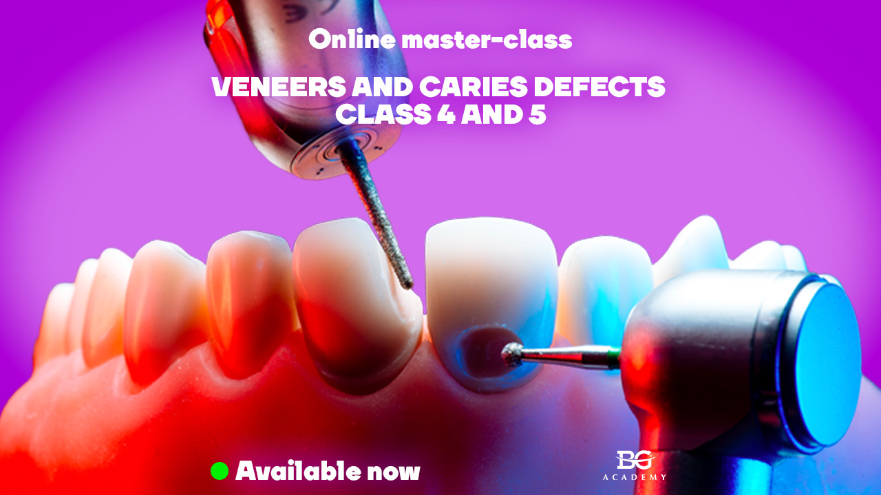 Veneers And Caries Defects Class 4 And 5 Clinical Aspects Of Preparation 