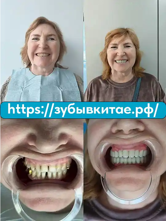 До и после — кейс 6