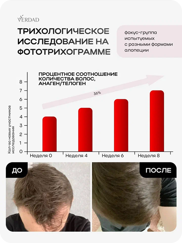Трихологическое исследование VERDAD: волосы в фазе анагена до и после курса