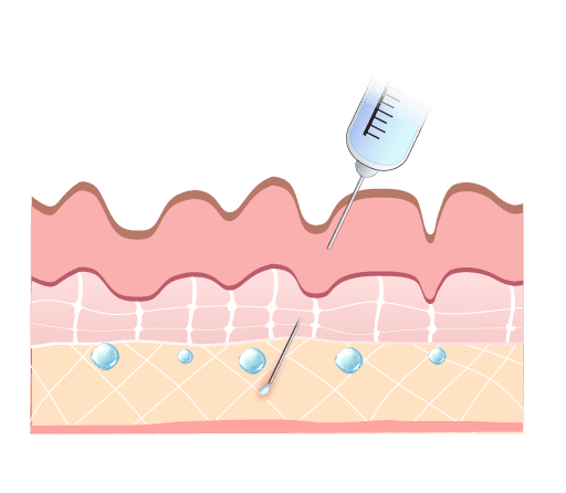 Плазмотерапия в Москве | клиника «Красивые люди»