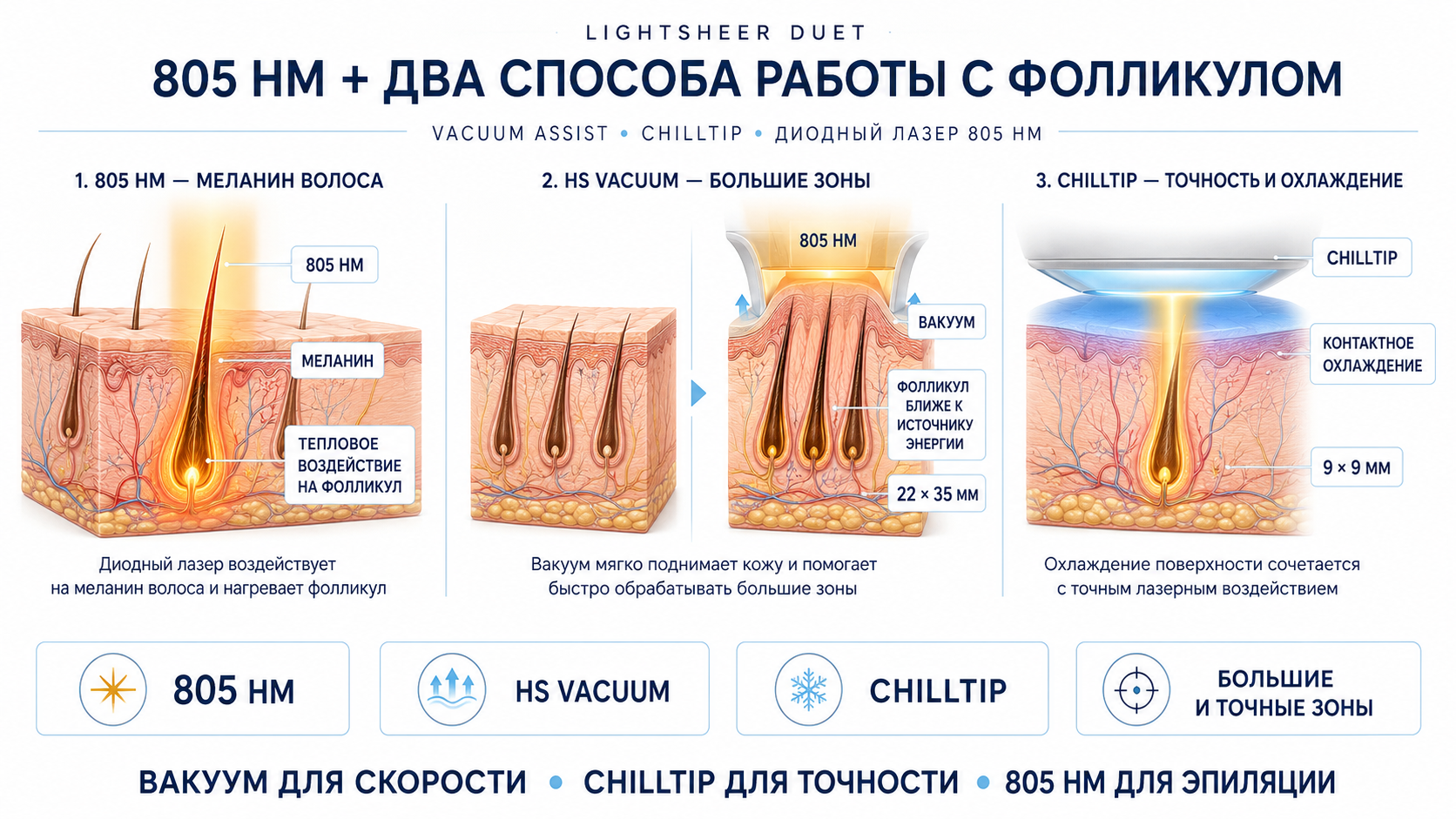 Схема LightSheer Duet: HS Vacuum и ET ChillTip