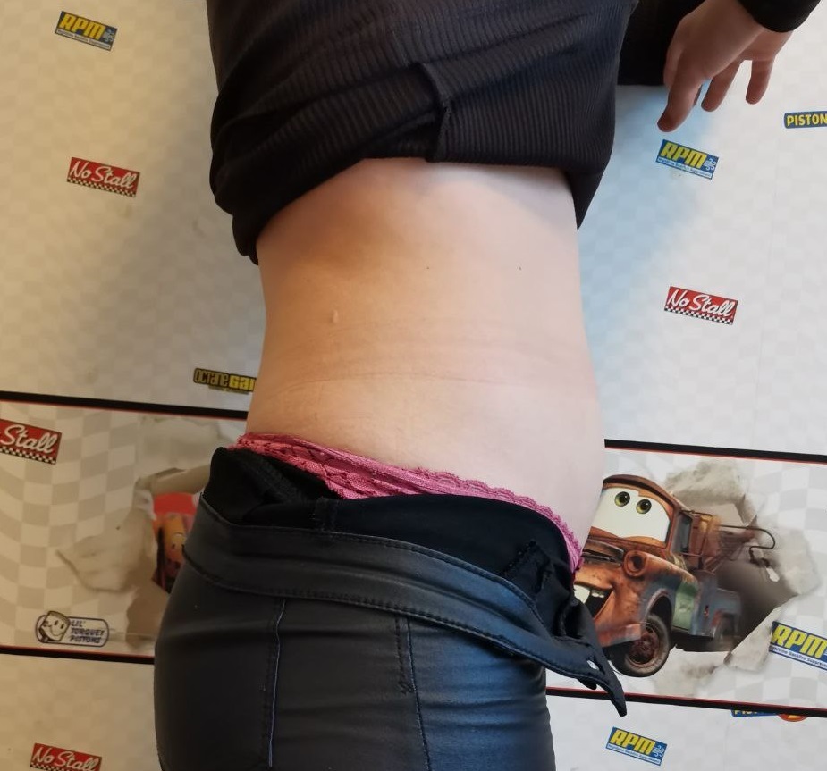 при стройном теле выпирает живот