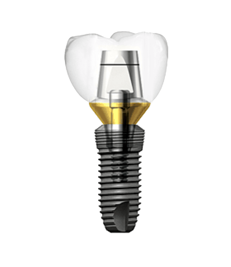 Имплантиум Суперлайн. Dentium Implantium. Имплант системы Implantium. Implantium Корея.