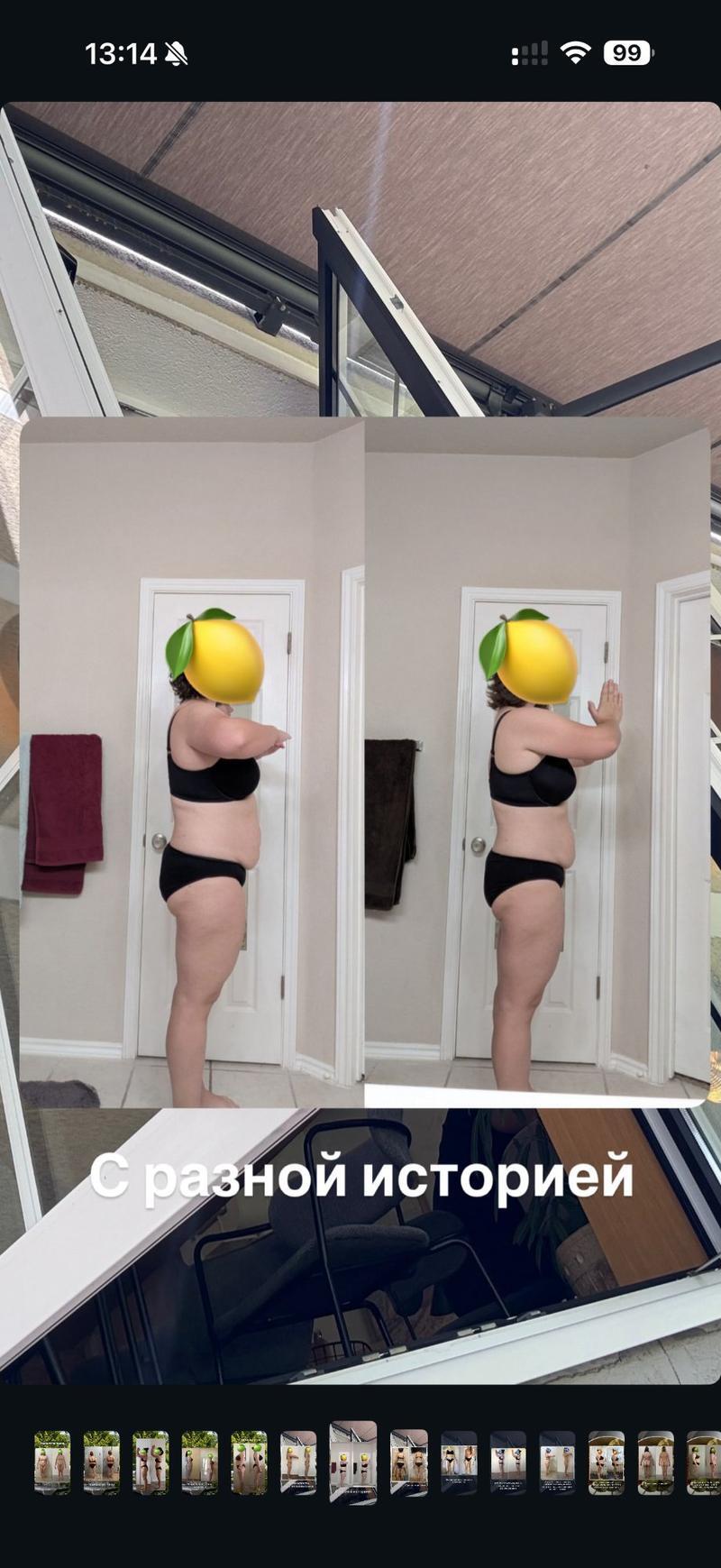 До и после ХМРЗ