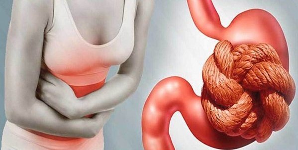 Чем опасен запор