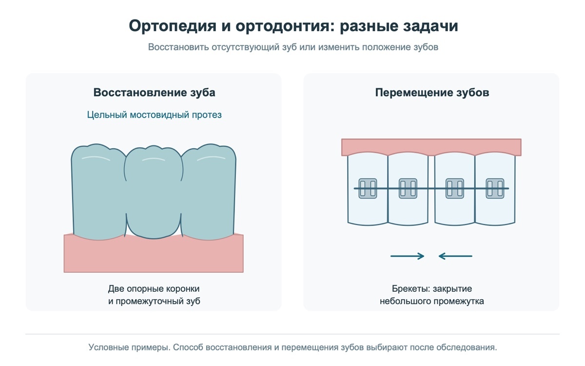 Разные задачи стоматолога-ортопеда и ортодонта