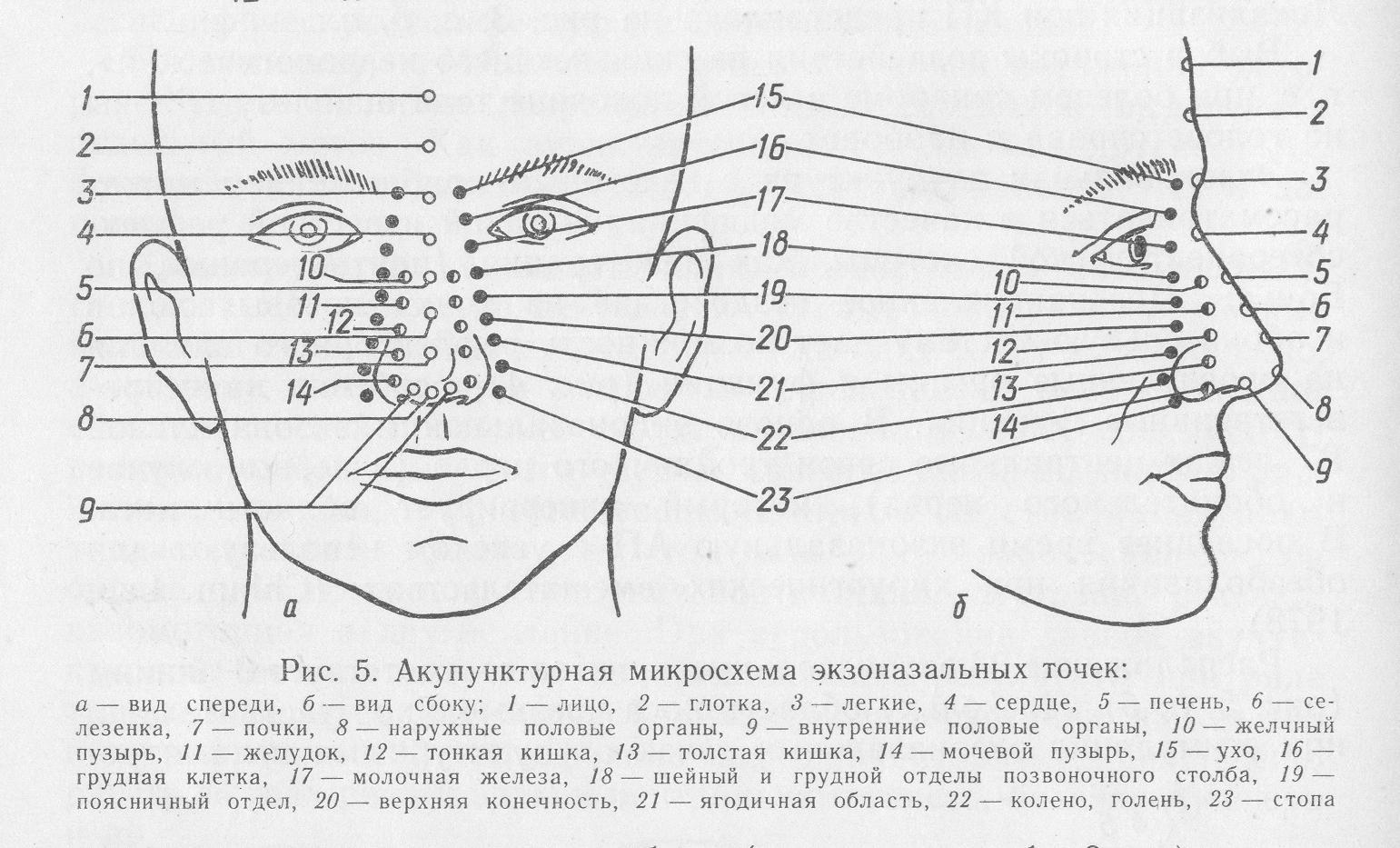 Акупунктурные точки на лице схема. Акупунктура тела человека схема болевые точки. Точки акупунктуры на лице человека. Акупунктура при неврите лицевого нерва.