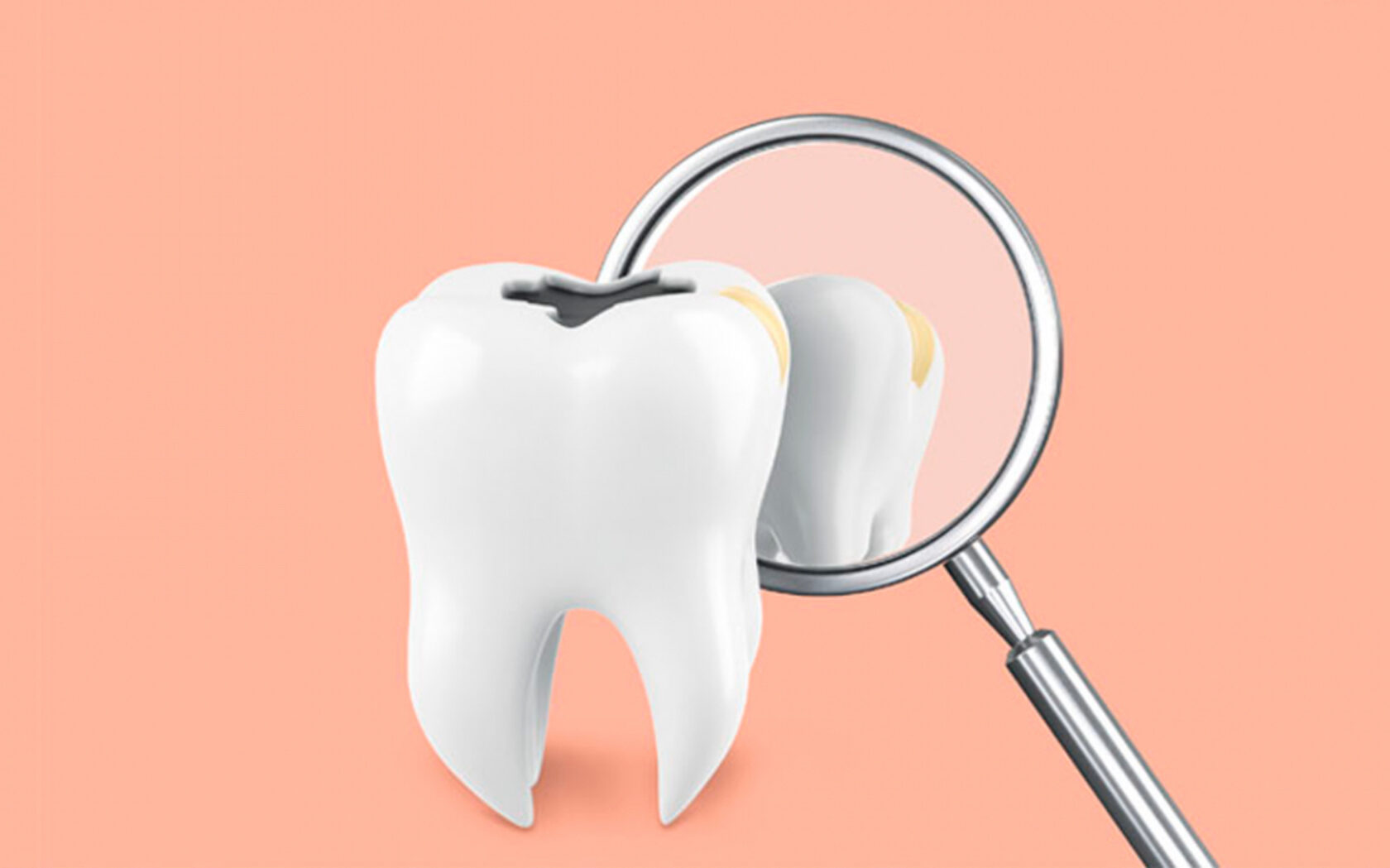 Зубы с кариесом стоматология