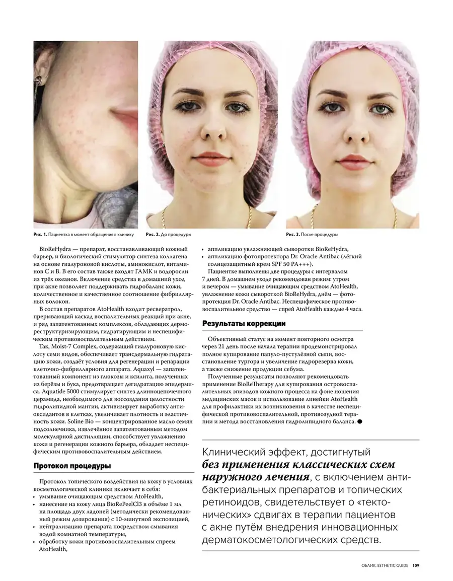 Журнал «Облик», с. 109: фото пациентки до и после, протокол и результаты