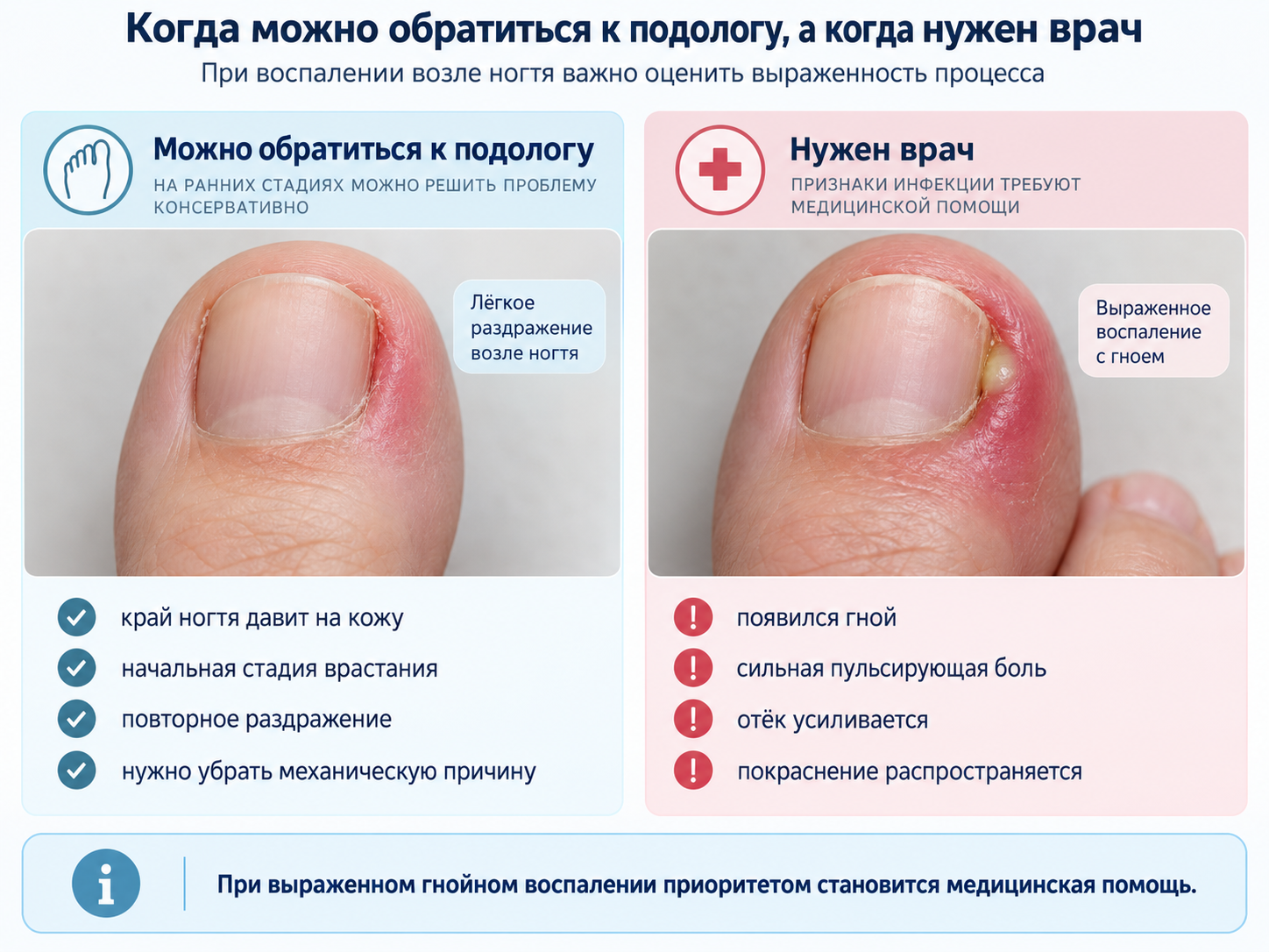 Когда при воспалении возле ногтя нужен врач