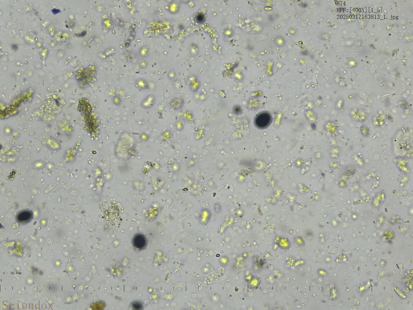 Снимок нативного препарата кала со станции Sciendox 2000R