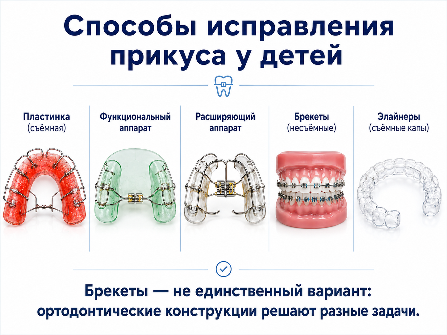 способы исправления прикуса у детей — пластинки аппараты брекеты элайнеры