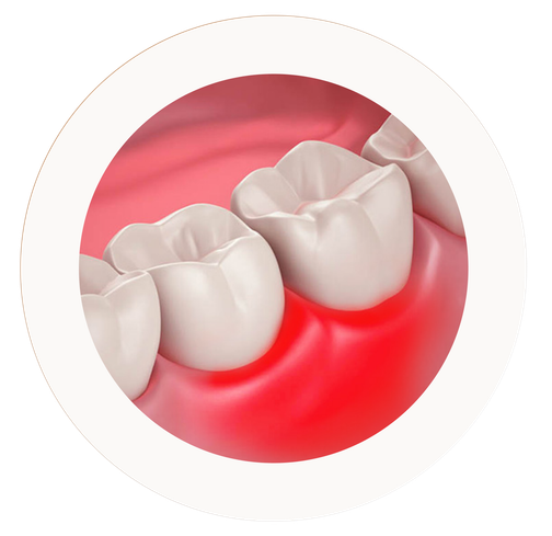 Пародонтология