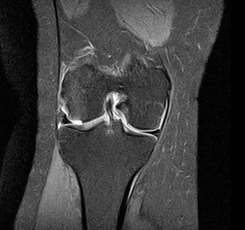 Arthroscopy. Injuries of the knee and shoulder joints.
