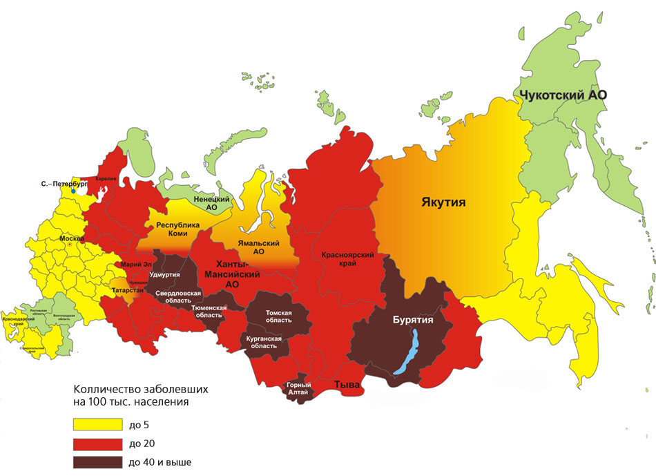 kleshevoi_encefalit_2
