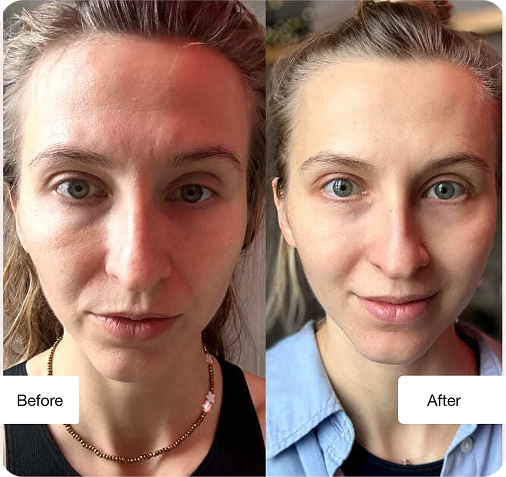 Before and after