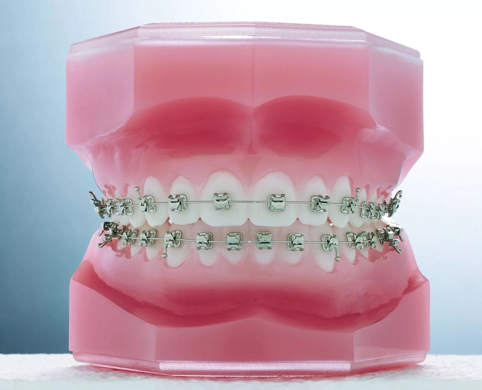 Lazin orthodontics