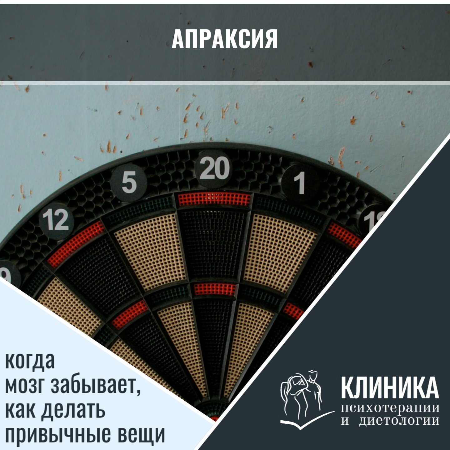 Апраксия: когда мозг забывает, как делать привычные вещи