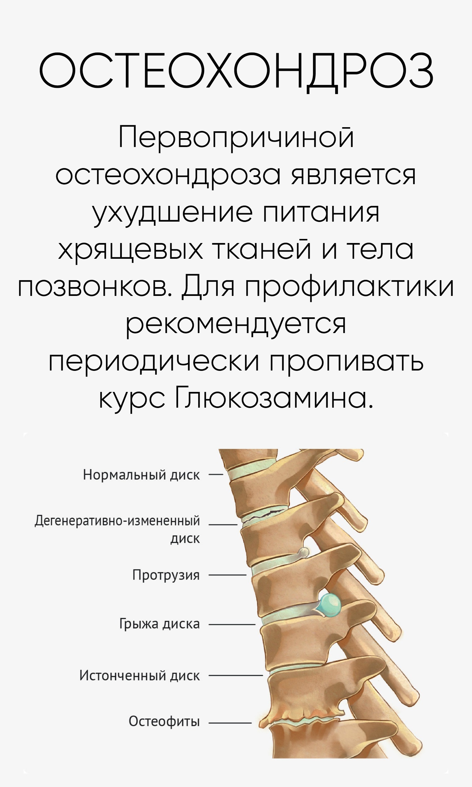 Краевые остеофиты тел позвонков что это такое фото