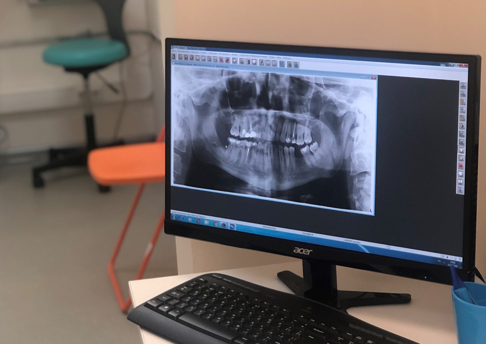 Рентген в стоматологии