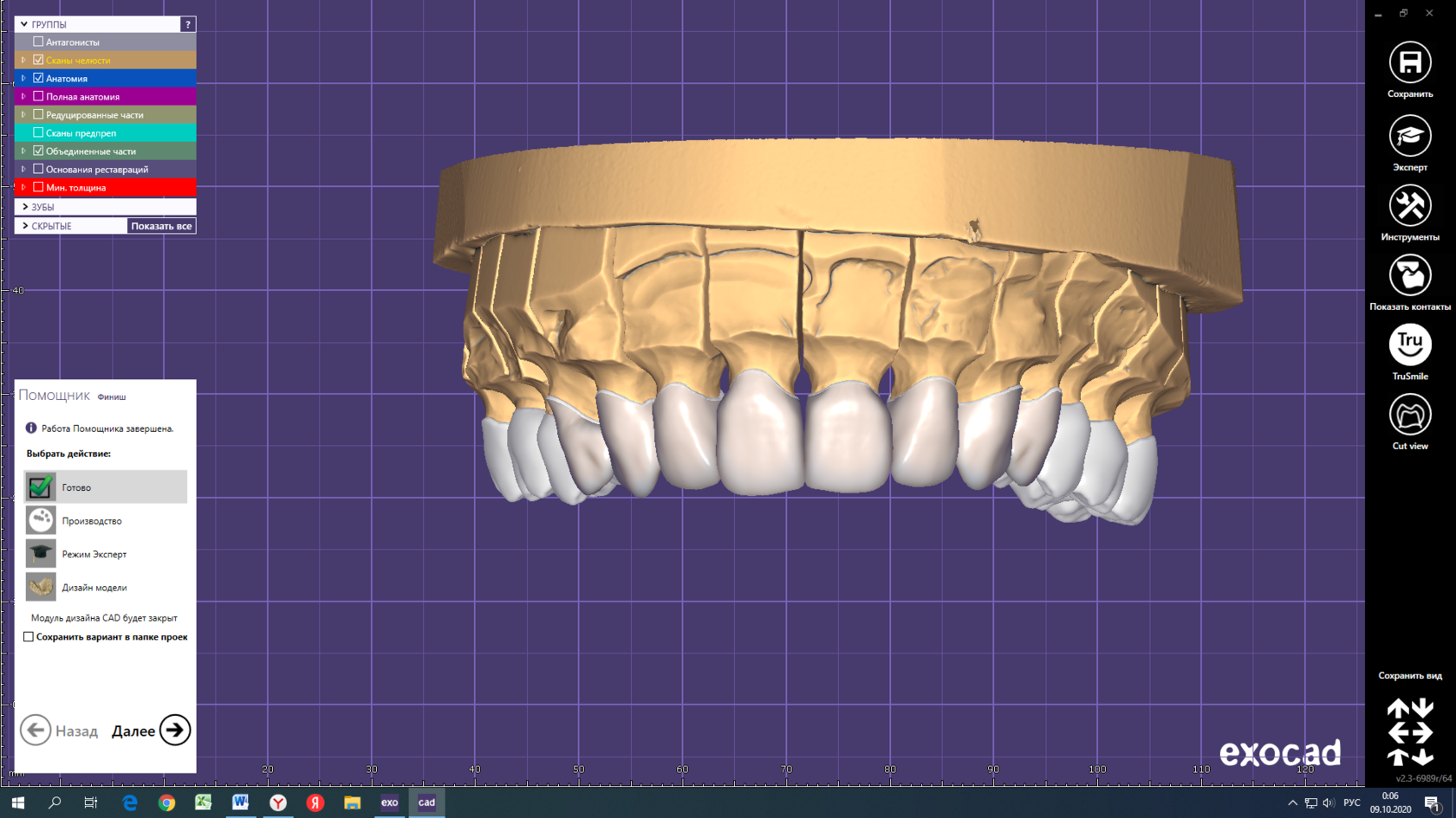 Моделирование в стоматологии. Exocad моделирование зубов. Моделировка зубов в exocad. CAD/cam моделирование exocad. Моделировка exocad моделирование зубов.