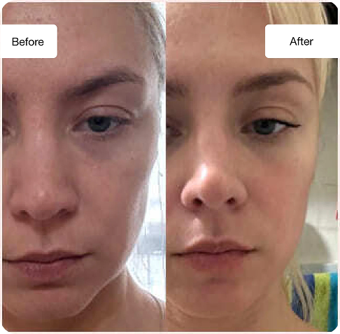 Before and after