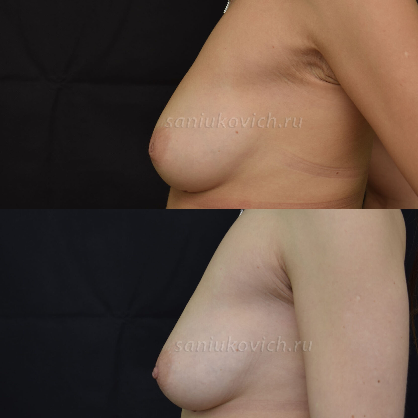 увеличилась одна грудь как перед месячными фото 7