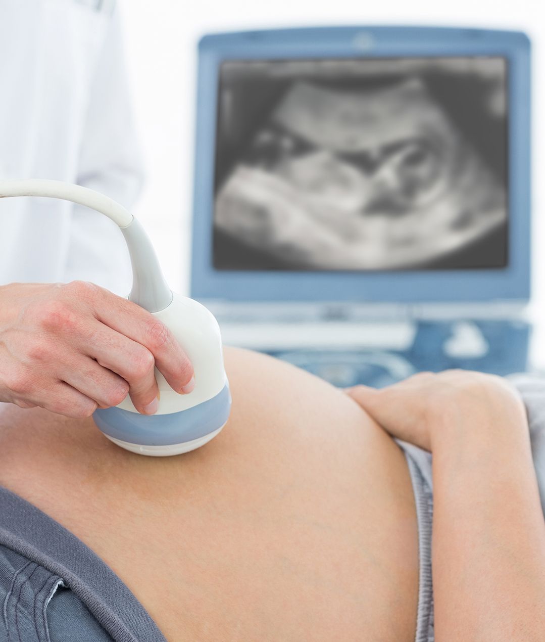 Допплерография ребенку. УЗИ. УЗИ при беременности. УЗИ В акушерстве и гинекологии.