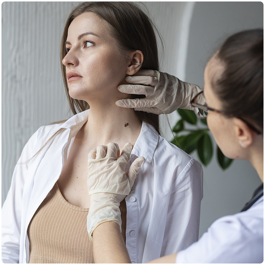 Удаление папиллом, родинок и бородавок в Москве рядом с м. Водный ...