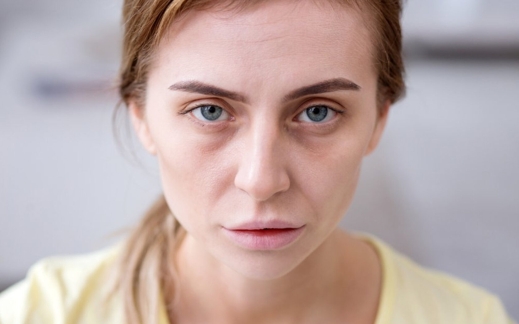 anemiya-chelovek-s-anemiej