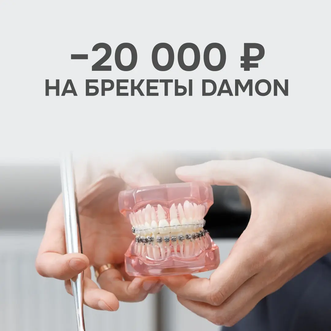 Акция: скидка 20 000 рублей на брекет-системы Damon