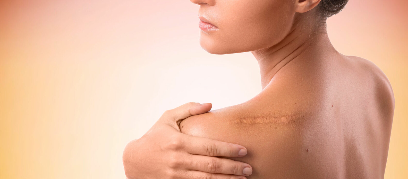 Коррекция Рубцов