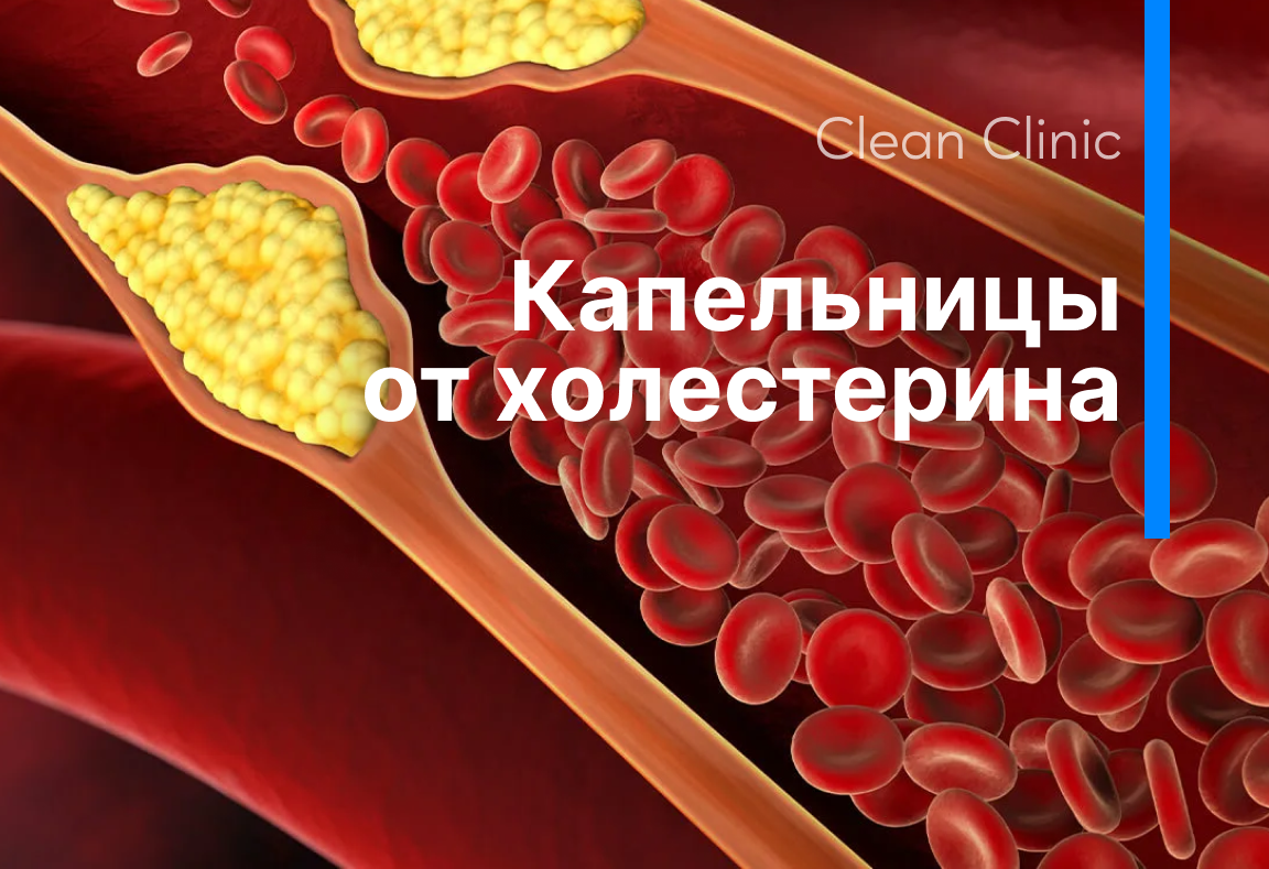 Капельница для снижения холестерина - Clean Clinic