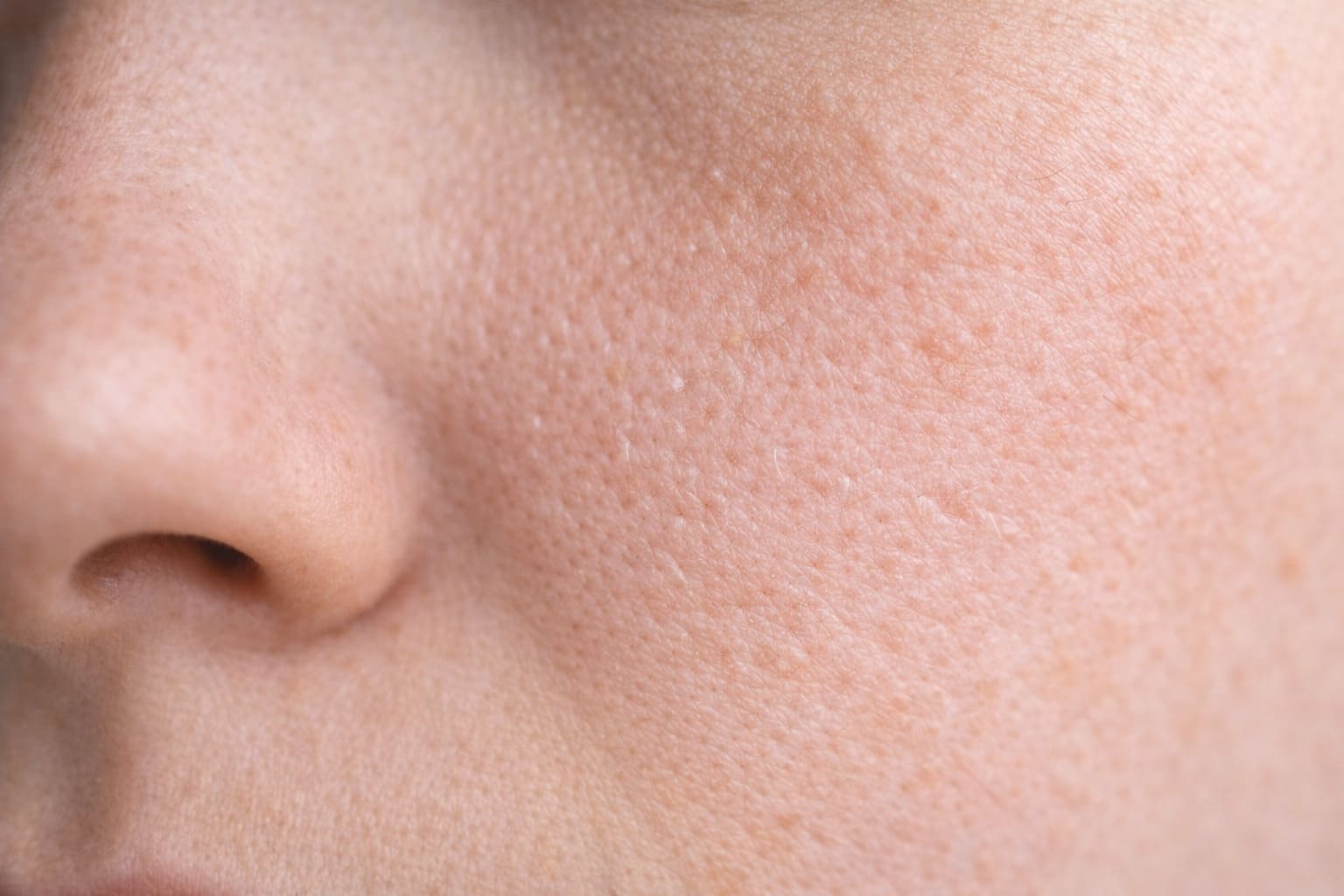 Ранние признаки возрастных изменений кожи: потеря упругости и тонуса