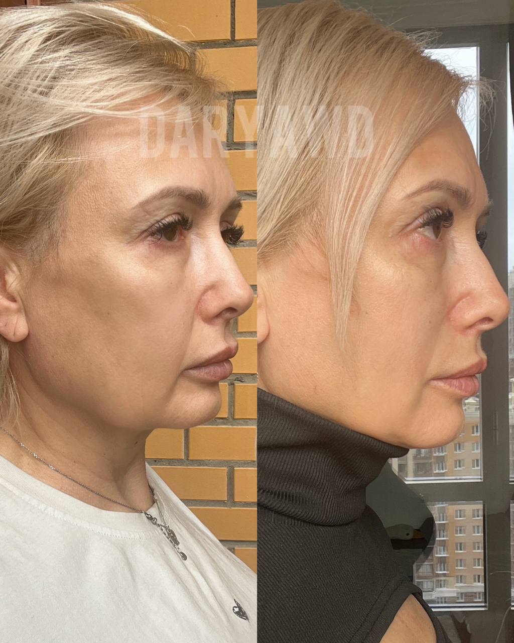 Елена, 48 лет