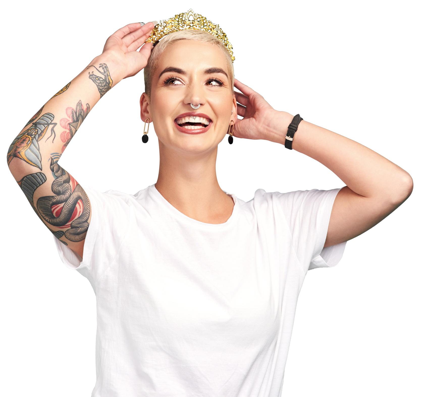 Кортикотомия: уменьшение времени ношения бректов | Импладент на Щёлковской