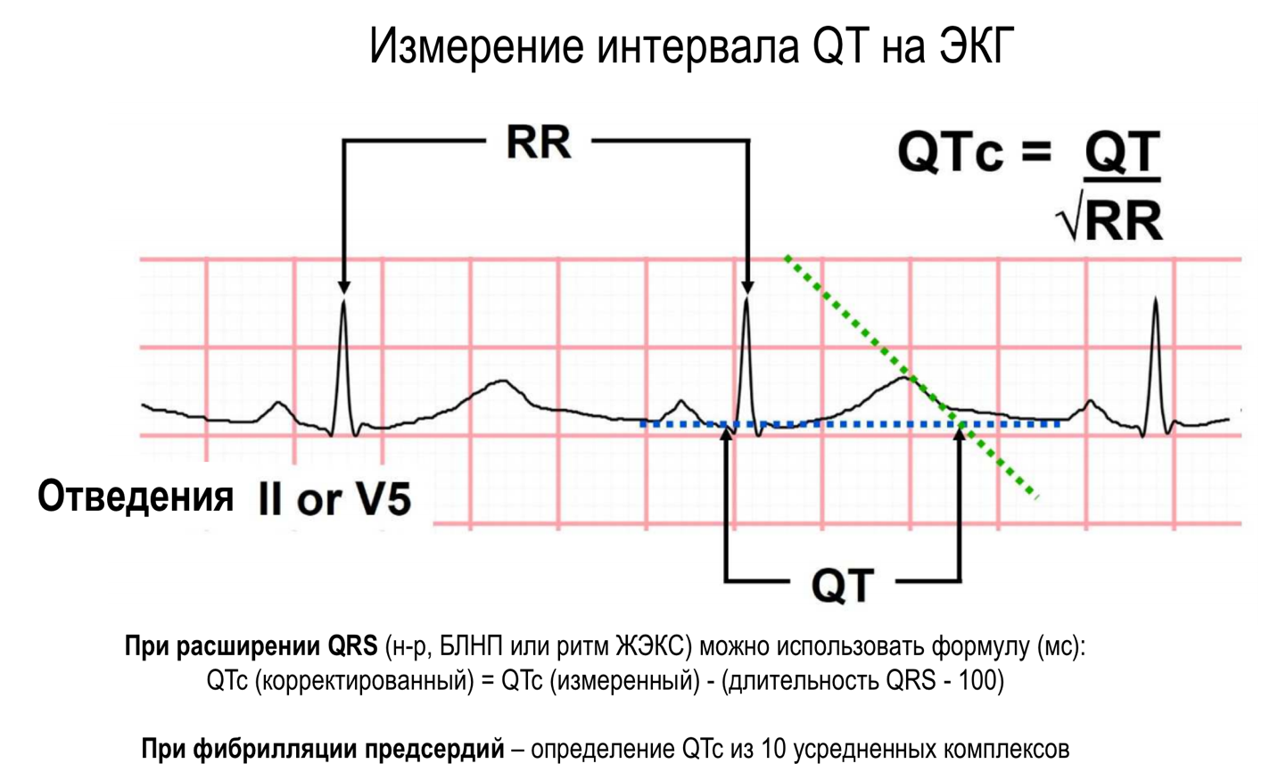 Что удлиняет интервал qt