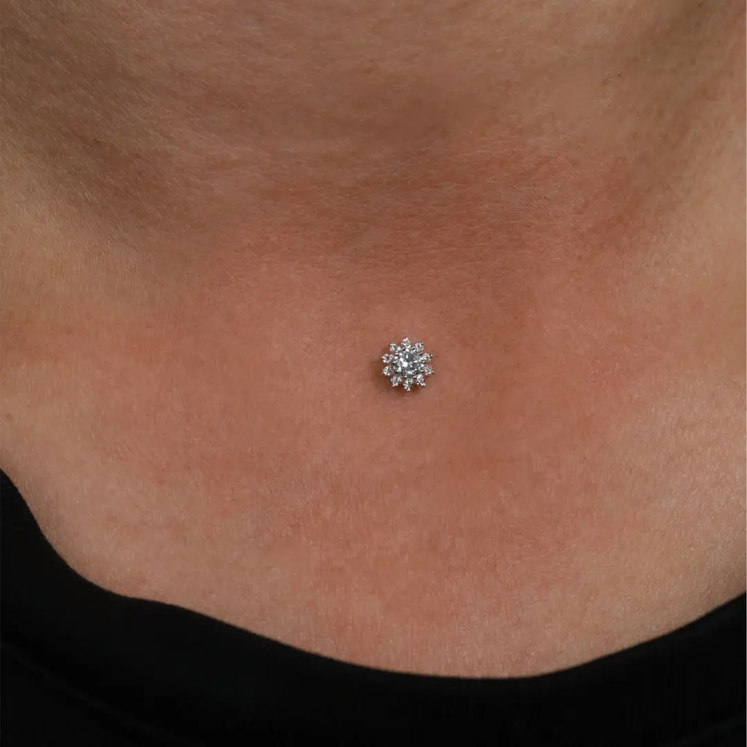 Установка&nbsp;микродермала