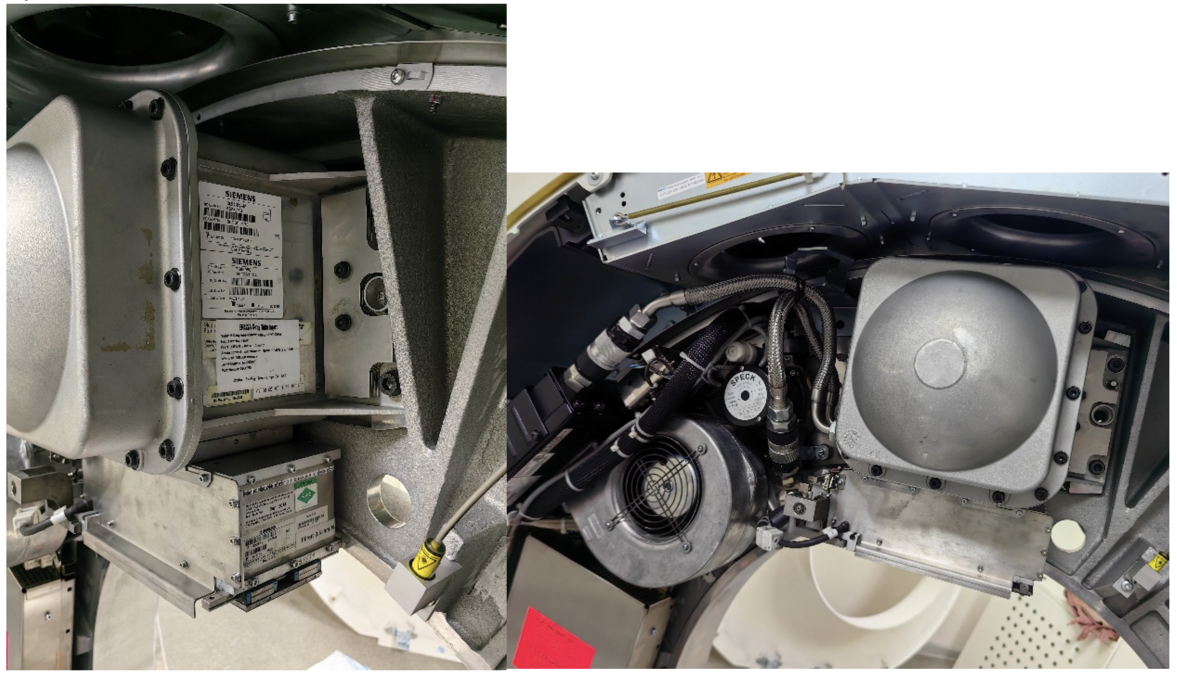 Установка трубки Dura 422 на томографе Siemens Emotion 16