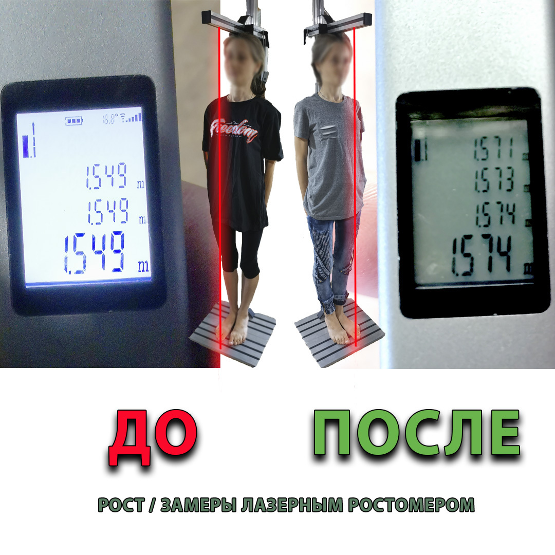 Фото ежедневного замера роста лазерным ростомером на 9ти дневном курсе по восстановлению позвоночника и суставов.
