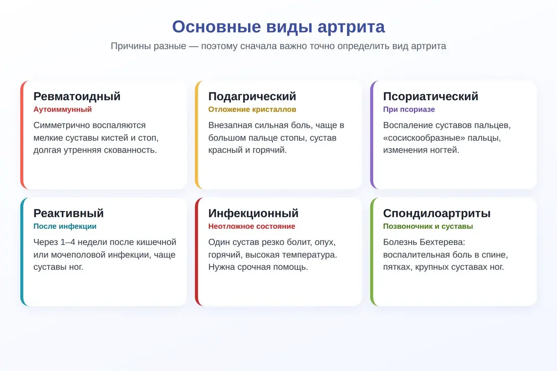 Виды артрита: ревматоидный, подагрический, псориатический, реактивный, инфекционный, спондилоартриты