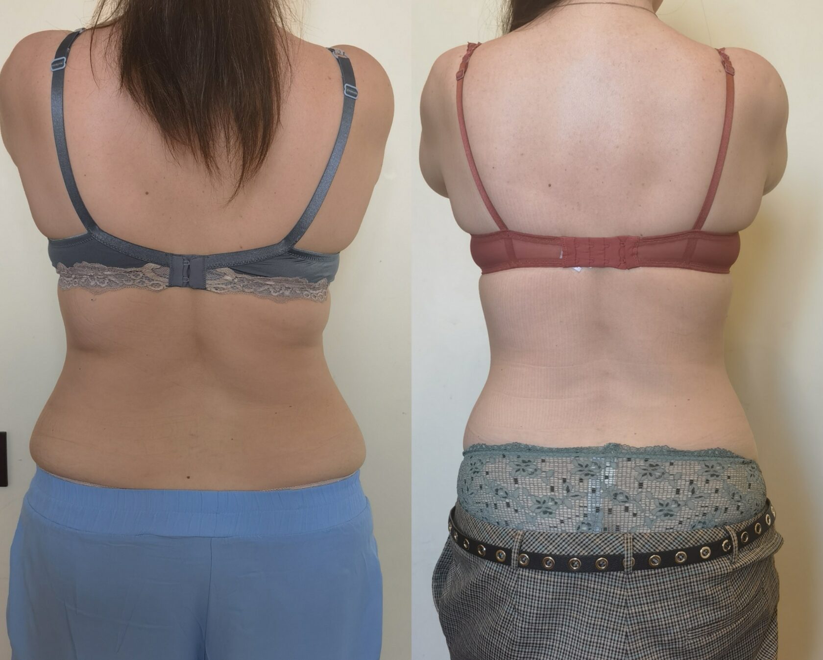 убрать бока