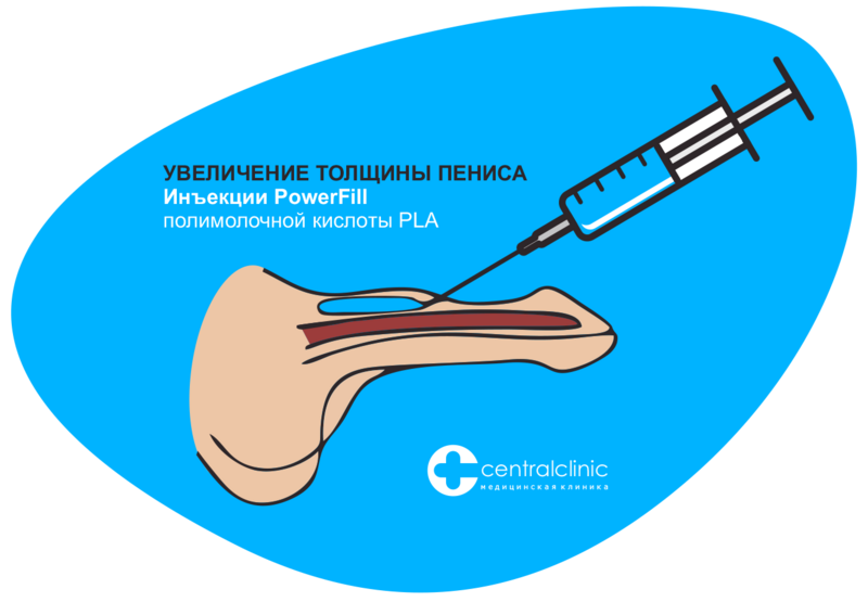 Ересектерге арналған порно фото